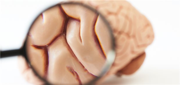 Ataxien sind seltene Hirnerkrankungen. Die Spezialambulanz für Ataxien am Uniklinikum Bonn fokussiert sich auf Patienten mit solchen Krankheiten.