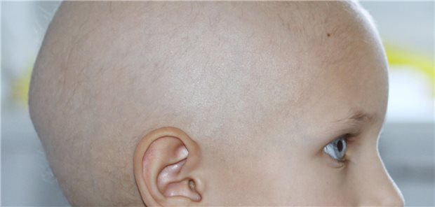 Auch Kinder können – oft im Sinne eines zugrundeliegenden Krebsprädispositionssyndroms – an Krebs erkranken. Eine frühzeitige und standardisierte Überwachung dieser Kinder kann laut Forschern aus Tennessee die Mortalität deutlich senken.