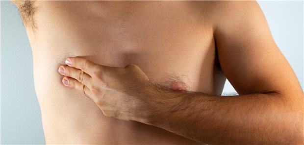 Auch Männer können Brustkrebs bekommen. Die bestehenden Therapieoptionen sind bei ihnen aber möglichweise weniger wirksam, als sie es bei Frauen sind.