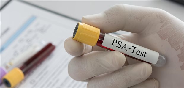 Ein Arzt hält ein Blutentnahmeröhrchen für einen Test auf Prostata-spezifisches Antigen in seiner Hand.