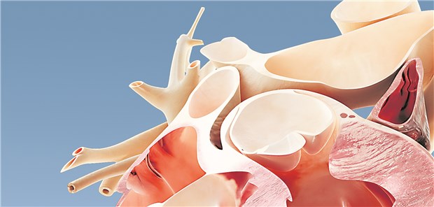 Auch auf Ebene der kardialen Strukturgene gibt es offenbar eine genetische Prädisposition für die alkoholische Kardiomyopathie.