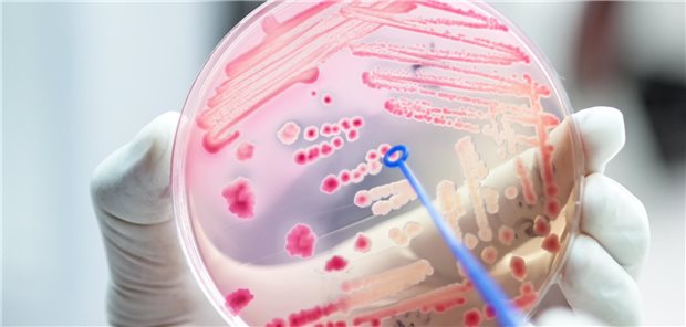 So lassen sich Antibiotika-Verordnungen im Praxisalltag reduzieren Bakterienkultur in Petrischale