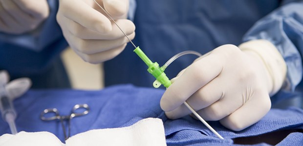 Katheter sticht konservative Therapie Auch bei über 80-jährigen Patienten mit instabiler Angina oder NSTE-Myokardinfarkt verbessert eine frühe invasive Therapie die Prognose.