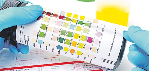 Auch der Stellenwert von Urinstreifentests zur Diagnose einer HWI ist fraglich.