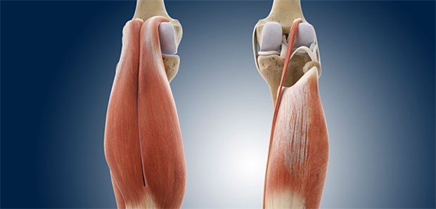 Die optimale Figur mit Botulinumtoxin A? Auch die Wade wird mit Botulinumtoxin geformt. Links der zweiköpfige Musculus gastrocnemius, rechts der darunterliegende Musculus soleus.