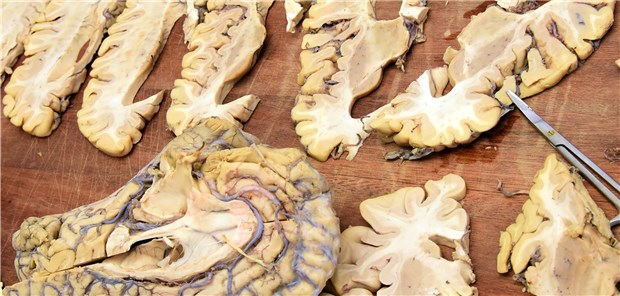 BÄK fordert Wissenschaftlichkeit und kritisiert Medical Schools Auch eine Basis für Wissenschaftlichkeit: Neuroanatomie im Medizinstudium.