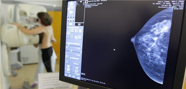 Frau bei der Mammographie.