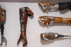 Sauerbruch – ein Arzt mit vielen Facetten Auch historische Prothesen sind in der Ausstellung zu sehen.