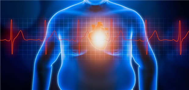 Auch in puncto Herzerkrankungen sind von Adipositas Betroffene eine besondere Patientengruppe.