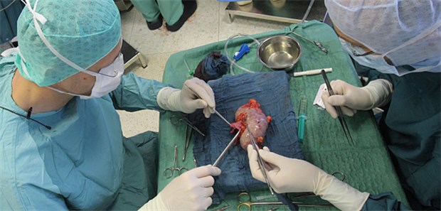 Gute Prognose auch bei Nieren zweiter Wahl Auch mit Organen von älteren oder kranken Spendern sind gute Transplantationsergebnisse zu erzielen.