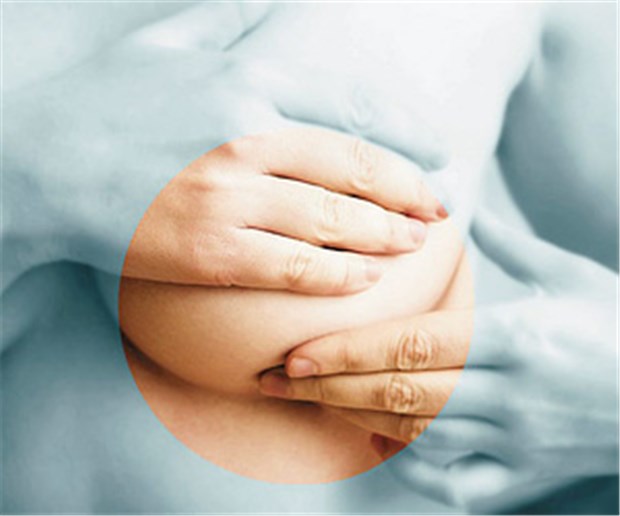 Brustkrebs: Rezidive noch nach zehn Jahren Auch nach zehn Jahren kann es bei Frauen mit Brustkrebs noch zu Lokalrezidiven mit Metastasen kommen. © Forgiss / fotolia.com
