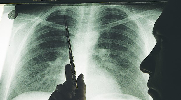 Auch wenn eine Röntgenaufnahme nur aus Vorsicht gemacht wird, muss sie gesamthaft begutachtet werden.