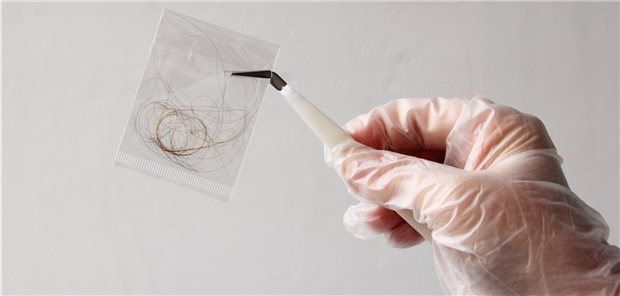Haare verraten, was beim Stressabbau hilft Auf dem Weg ins Labor. Haare können einiges verraten. Auch, wieviel Stress eine Person hat.