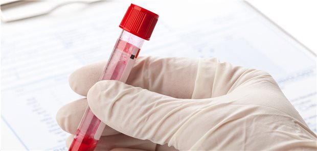 Blutprobe auf dem Weg ins Labor zur PTH-Bestimmung. 