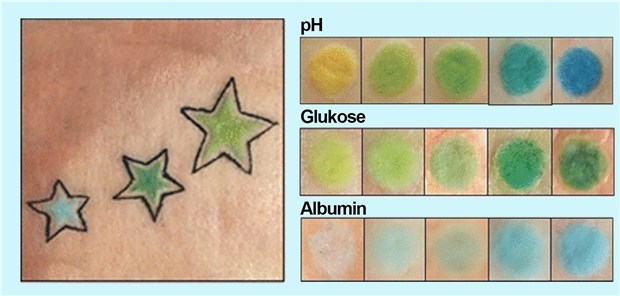 Auf den tätowierten Hautpartien signalisiert ein Farbumschlag eine Veränderung des pH-Werts oder der Konzentration von Parametern wie Glukose oder Albumin.
