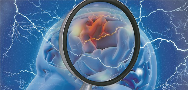 Auf der Suche nach einem Angriffsziel bei Alzheimer: Beta-Amyloid hat hier wohl Potenzial.