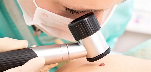 Ein Hautarzt untersucht die Haut mit einem Dermatoskop auf Melanom.