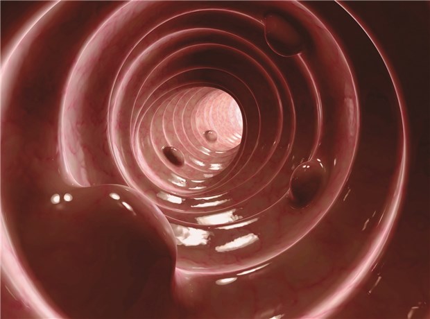 Darmreinigung: freie Sicht dem Koloskopiker Auf einer gut gereinigten Darmmukosa wird so einfach kein Polyp oder Karzinom übersehen. © Martin Ruge / Fotolia.com