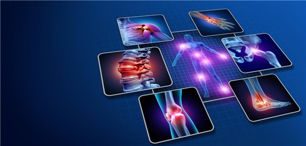 Auffällig und auch im SELENA-SLEDAI signifikant war nur eine vermehrte arthritische Aktivität bei systemischem Lupus erythematodes plus Fibromyalgiesyndrom. Das heißt, dass  Patienten, die beides hatten, hatten häufiger mehr als zwei objektiv geschwollene Gelenke.