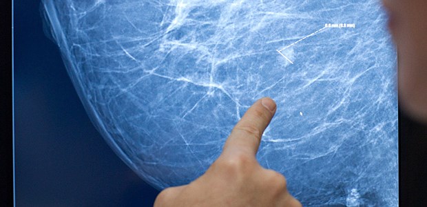 Aufbruchstimmung in der Krebsmedizin Auffälliges Gewebe: Wird die Personalisierung die Onkologie beflügeln?