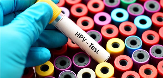 Ein Röhrchen mit einer Blutprobe für einen Test auf das humane Papillomvirus.