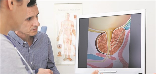 Prostata-Ca – Wie steht es um die Lebensqualität? Aufklärung zur Prostata und ihrer Funktion: Wichtiger Part in der Betreuung von Patienten mit Prostata-Ca.