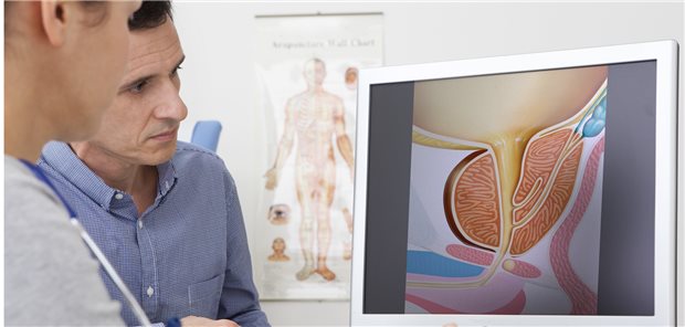 Aufklärungsgespräch zur Prostata. Was ist nach einer MRT-basierten Diagnose „Prostatitis“ zu tun? (Symbolbild mit Fotomodellen)