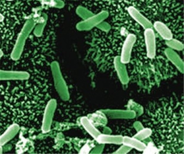 Gefährliches Darmbakterium hat Deutschland erreicht Aufnahme von Clostridium difficile. Einige Stämme lösen schwere Kolitiden aus.