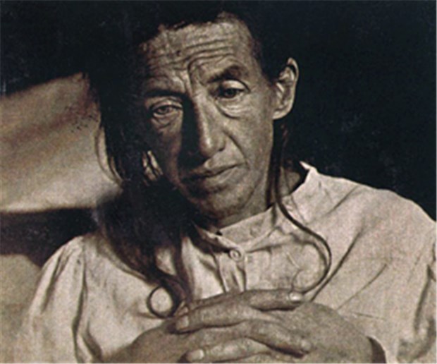 Erster Alzheimer-Fall aufgeklärt Auguste Deter: Auch knapp 100 Jahre nach ihrem Tod konnte sie der Wissenschaft noch helfen.