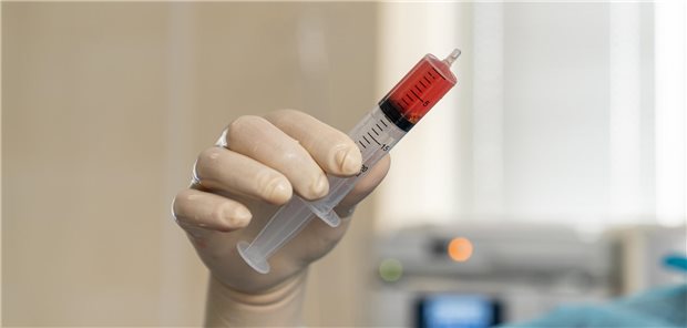 Aus Sicht der Forscherinnen und Forschern des Universitätsklinikums Carl Gustav Carus Dresden und des Nationalen Zentrums für Tumorerkrankungen Dresden können Patientinnen und Patienten mit refraktärer bzw. rezidivierender AML umgehend Stammzellen transplantiert werden, wenn ein passender Spender zur Verfügung steht. Das unterstreiche die Notwendigkeit, möglichst früh nach einem geeigneten Spender zu suchen.