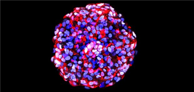 Aus Stammzellen gewonnener Betazellen-Cluster: Solche Zellen wurden für die Erforschung der Pathogenese bei MODY3-Diabetes genutzt.