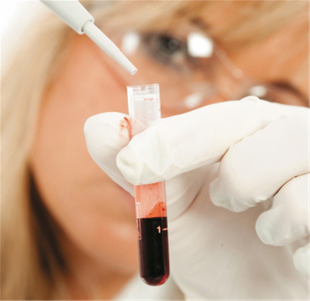 Aus dem Blut ergibt sich die Diabetes-Diagnose. Aber anhand welchen Kriteriums - das ist in der Diskussion. © Moments / fotolia.com