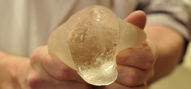 PIP-Brustimplantate doch nicht giftig? Ausgequetscht: PIP-Gel.