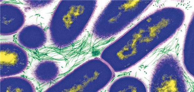 Auslöser von Ulcus molle: Hämophilus ducreyi.
