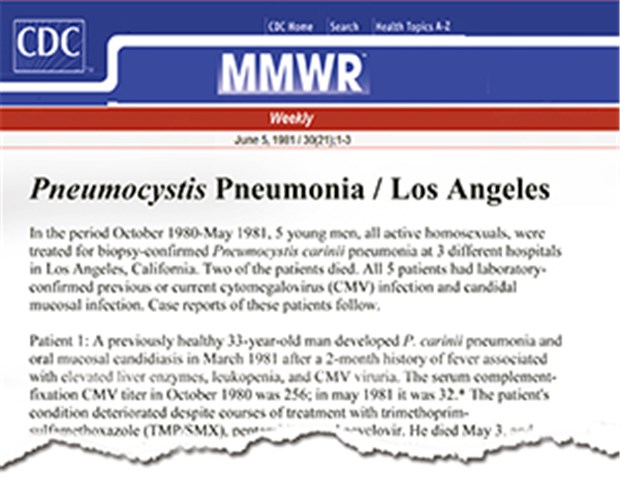 Ungewöhnliche Befunde bei jungen Männern in USA Ausriss der ersten Seite des Berichts über gehäuft auftretende Pneumocystis-Pneumonien im MMW-Report am 5. Juni 1981.
