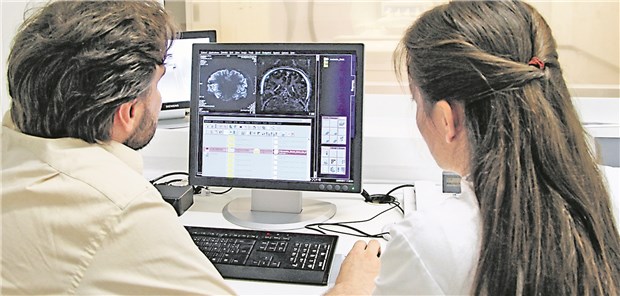 Schwaches Herz – schwaches Hirn Auswertung von MRT-Bildern: Würzburger Forscher fanden heraus, dass die Atrophien des Temporallappens bei Herzschwächepatienten im Zusammenhang mit ihren kognitiven Beeinträchtigungen standen.