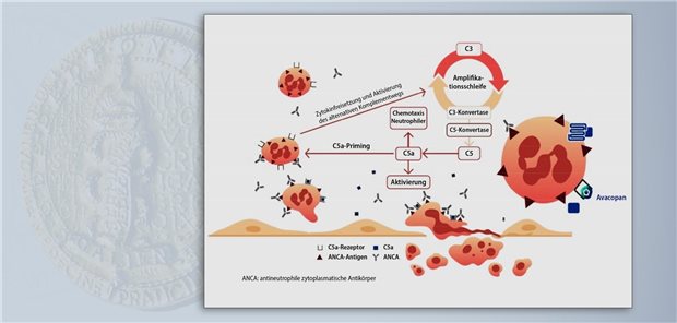 Avacopan hemmt selektiv den C5a-Rezeptor im alternativen Weg der Komplementaktivierung und verhindert so die durch ANCA ausgelöste Zerstörung der neutrophilen Granulozyten.