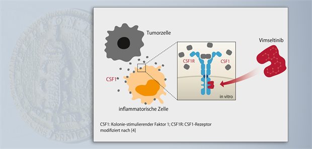Erste systemische Therapie tenosynovialer Riesenzelltumoren BU ???