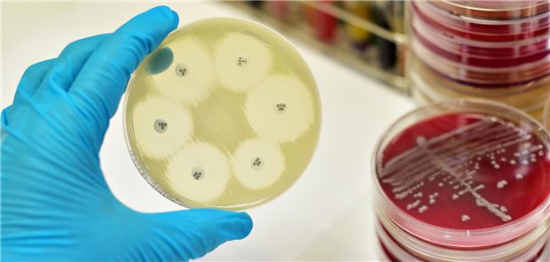 Bakterielle Kolonien: Forscher haben untersucht, wie es dazu kommt, dass Bakterien Resistenzen gegen Antibiotika entwickeln.