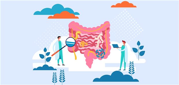 Bakterien im Darm unter die Lupe genommen haben Forscher in den USA: Wer viele Schwefelbakterien im Darm hat, hat ein erhöhtes Darmkrebsrisiko.