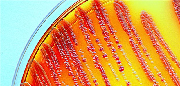 Bakterien in einer Petrischale: Wie lässt sich in der Behandlung von Patienten mit STI Antibiotika-Resistenzen entgegenwirken?