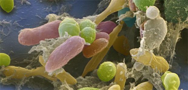Wie kommen die Erreger in die Klinik? Bakterien in einer Stuhlprobe. Die Wissenschaftler konzentrierten sich bei ihrer Forschung auf 3. Generations-Cephalosporin-resistenten Enterobakterien.