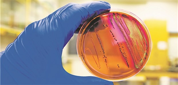 Was verhindert Resistenzen am besten? Bakterienkultur: Durch ABS-Programme sank die Inzidenz von MRSA um 37 Prozent.