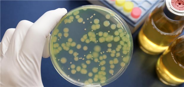 Neue Fixkombi gegen multiresistente Keime Bakterienkultur im Blick: Bei Infektionen mit Metallo--Laktamase-bildenden Bakterien gibt es eine neue Therapieoption. (Symbolbild) cassis / stock.adobe.com