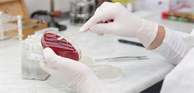 Bakterienkultur in der Petrischale: Vor allem bei resistenten Keimen ist es wichtig, dass Reserveantibiotika verfügbar sind.