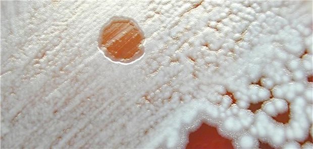 Bakteriophagen sind spezielle Viren, die ausschließlich Bakterien angreifen. Hier im Bild: Phagen bilden einen kreisrunden Lysehof in einer Bakterienkultur.