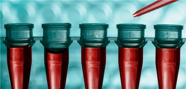 Industrie warnt vor Ausfall wichtiger Labordiagnostika Bald Ebbe im Labor? Der neue europäische Rechtsrahmen für In-vitro-Diagnotika könnte vielen Altprodukten kurzfristig zum Verhängnis werden.
