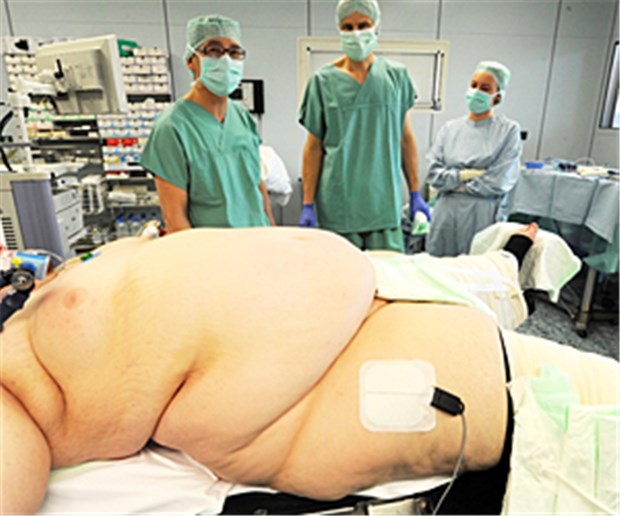 Operation bringt 'Heilung' Bariatrische Chirurgie bietet auch Patienten mit extremer Adipositas Therapiechancen.