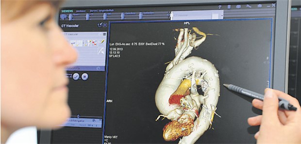 Offene Op schlägt langfristig die endovaskuläre Therapie Bauchaorten-Aneurysma: Nach einer Ruptur sterben immer noch drei von vier Betroffenen .