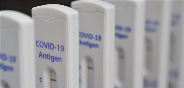 Ärzteverbände fordern: Schluss mit den Corona-Bürgertests Bayern hat das Testregime schon eingedampft. Bei der Gesundheitsministerkonferenz von Bund und Ländern am Montag könnten weitere Länder nachziehen.